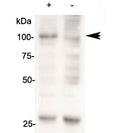 Western blot of 143B cells overexpressing human AARS2 tested with AARS2 antibody (mock transfection in lane 2). Predicted molecular weight: ~107kDa.