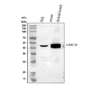 Western blot analysis of LRRC30 using anti-LRRC30 antibody. Lane 1: human Hela whole cell lysates, Lane 2: mouse skeletal muscle tissue lysates. After electrophoresis, proteins were transferred to a nitrocellulose membrane at 150 mA for 50-90 min. Blocked the membrane with 5% non-fat milk/TBS for 1.5 hour at RT.