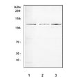 Western blot testing of 1) rat testis, 2) mouse testis and 3) mouse thymus tissue lysate with TRIF antibody. A single TRIF band was detected between ~100-110 kDa, migrating above the predicted 76 kDa, consistent with the well-documented phosphorylation-dependent and proline-rich region-related upward mobility of endogenous TRIF reported in the literature.