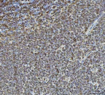 IHC staining of FFPE human tonsil tissue with Histone deacetylase 1 antibody. HIER: boil tissue sections in pH8 EDTA for 20 min and allow to cool before testing.