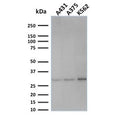 Western blot testing of human samples with Replication Protein A2 antibody (clone SPM316). Expected molecular weight ~32 kDa.