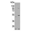 Western blot testing of 1) non-transfected and 2) transfected 293 cell lysate with ALDH5A1 antibody. Predicted molecular weight ~57 kDa.