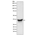 Western blot testing of human K562 cell lysate with Nix antibody. Expected molecular weight: ~38 kDa (monomer), ~76 kDa (homodimer).
