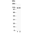 Western blot testing of ATP2A2 antibody and Lane 1: rat skeletal muscle; 2: mouse skeletal muscle; Expected molecular weight ~115 kDa.