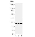 Western blot testing of Oncostatin M antibody and Lane 1: A549; 2: A549; 3: HeLa cell lysate. Expected/observed molecular weight ~28 kDa (precursor), ~24 kDa (pro form), ~28 kDa (glycosylated pro form).