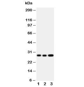 Western blot testing of Oncostatin M antibody and Lane 1: A549; 2: A549; 3: HeLa cell lysate. Expected/observed molecular weight ~28 kDa (precursor), ~24 kDa (pro form), ~28 kDa (glycosylated pro form).