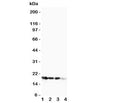 Western blot testing of FGF1 antibody and Lane 1: 10ng; 2: 5ng; 3: 2.5ng; 4: SMMC-7721 cell lysate. Expected molecular weight ~17 kDa.