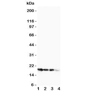 Western blot testing of FGF1 antibody and Lane 1: 10ng; 2: 5ng; 3: 2.5ng; 4: SMMC-7721 cell lysate. Expected molecular weight ~17 kDa.
