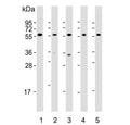 Western blot testing of human 1) HepG2, 2) Li-7, 3) U-87 MG, 4) testis and 5) mouse testis lysate with DHCR7 antibody. Predicted molecular weight ~54 kDa.