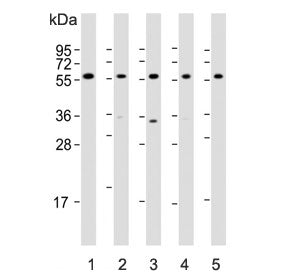 Western blot testing of human 1) HepG2, 2) Li-7, 3) U-87 MG, 4) testis and 5) mouse testis lysate with DHCR7 antibody. Predicted molecular weight ~54 kDa.