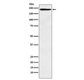 Western blot testing of human tonsil lysate with DEC-205 antibody. Predicted molecular weight: 199-215 kDa.