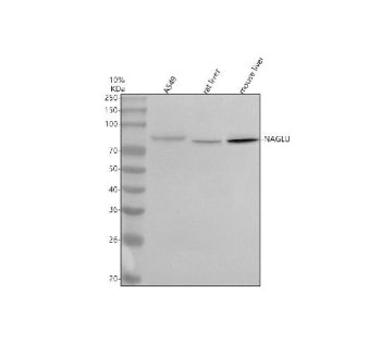 Western blot analysis of NAGLU using anti-NAGLU antibody. Lane 1: human whole cell lysates, Lane 2: rat liver tissue lysates, Lane 3: mouse liver tissue lysates. After electrophoresis, proteins were transferred to a nitrocellulose membrane at 150 mA for 50-90 min. Blocked the membrane with 5% non-fat milk/TBS for 1.5 hour at RT.