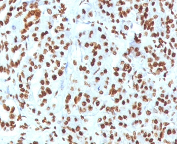 IHC staining of FFPE human pancreas tissue with recombinant Histone H1 antibody (clone OSHT-3R). Required HIER: boil tissue sections in pH 9 10mM Tris with 1mM EDTA for 10-20 min.