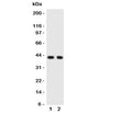 Western blot testing of CXCR5 antibody and Lane 1: rat spleen; 2: human HeLa cell lysate. Predicted molecular weight ~43 kDa.