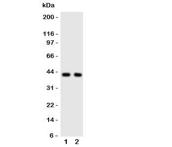 Western blot testing of CXCR5 antibody and Lane 1: rat spleen; 2: human HeLa cell lysate. Predicted molecular weight ~43 kDa.