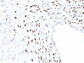 IHC: Formalin-fixed, paraffin-embedded human cervix stained with HPV-16 L1 antibody (clone HPV16L1/1058).