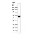 Western blot testing of human skeletal muscle tissue lysate using Muscle Actin antibody (clone rMSA/953). Predicted molecular weight ~45 kDa.