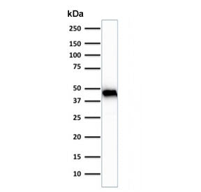 Western blot testing of human skeletal muscle tissue lysate using Muscle Actin antibody (clone rMSA/953). Predicted molecular weight ~45 kDa.