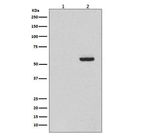 Western blot testing of 1) lysate from alkaline phosphatase-treated SH-SY5Y cells and 2) lysate from untreated SH-SY5Y cells, with phospho-Tau antibody (pS396). The S396 site is naturally highly phosphorylated and negative testing results after phosphatase treatment demonstrates the specificity of the phospho-Tau antibody. Expected molecular weight: 50-80 kDa.