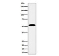 Western blot testing of human SW480 cell lysate with Aldehyde dehydrogenase 7A1 antibody. Predicted molecular weight ~58 kDa.