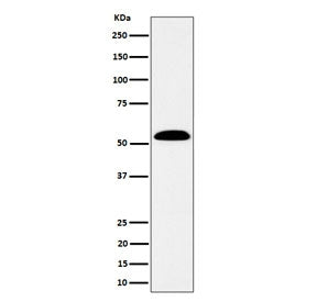Western blot testing of human SW480 cell lysate with Aldehyde dehydrogenase 7A1 antibody. Predicted molecular weight ~58 kDa.