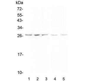 Western blot testing of 1) human PANC-1, 2) human SGC-7901, 3) human A549, 4) rat testis and 5) mouse testis lysate with VAPB antibody at 0.5ug/ml. Predicted molecular weight ~27 kDa.