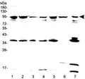 Western blot testing of human 1) HeLa, 2) 293T, 3) SKOV3, 4) A549, 5) MCF7, 6) placenta and 7) PANC-1 lysate with FES antibody at 0.5ug/ml. Predicted molecular weight ~93 kDa.