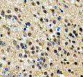 Immunohistochemical staining of NPAT using anti-NPAT antibody. NPAT was detected in a paraffin-embedded section of mouse brain tissue. Heat mediated antigen retrieval was performed in EDTA buffer (pH 8.0, epitope retrieval solution). The tissue section was blocked with 10% goat serum. The tissue section was then incubated with 2 ug/ml rabbit anti-NPAT antibody overnight at 4oC. Peroxidase Conjugated Goat Anti-rabbit IgG was used as secondary antibody and incubated for 30 min at 37oC.