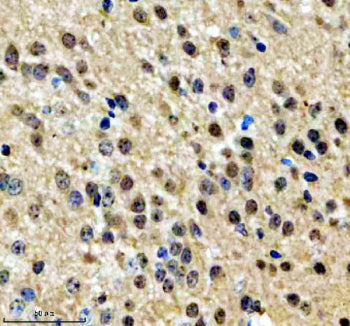 Immunohistochemical staining of NPAT using anti-NPAT antibody. NPAT was detected in a paraffin-embedded section of mouse brain tissue. Heat mediated antigen retrieval was performed in EDTA buffer (pH 8.0, epitope retrieval solution). The tissue section was blocked with 10% goat serum. The tissue section was then incubated with 2 ug/ml rabbit anti-NPAT antibody overnight at 4oC. Peroxidase Conjugated Goat Anti-rabbit IgG was used as secondary antibody and incubated for 30 min at 37oC.