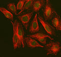 Immunofluorescent staining of NOL9 using anti-NOL9 antibody (green) and anti-Beta Tubulin antibody (red). NOL9 was detected in an immunocytochemical section of U2OS cells. Enzyme antigen retrieval was performed using IHC enzyme antigen retrieval reagent for 15 mins. The cells were blocked with 10% goat serum. And then incubated with 5 ug/ml rabbit anti-NOL9 antibody and mouse anti-Beta Tubulin antibody overnight at 4oC.
