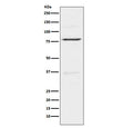 Western blot testing of human HeLa cell lysatse with INSRR antibody. Expected molecular weight: ~80 kDa, 144 kDa.