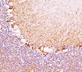 IHC testing of cerebellum stained with Neurofilament Heavy antibody (RT97).