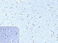 IHC staining of FFPE human brain tissue with Oligodendrocyte transcription factor 2 antibody (clone OLIG2/9995R). Inset: PBS used in place of primary Ab (secondary Ab negative control). HIER: boil tissue sections in pH 9 10mM Tris with 1mM EDTA for 20 min and allow to cool before testing.