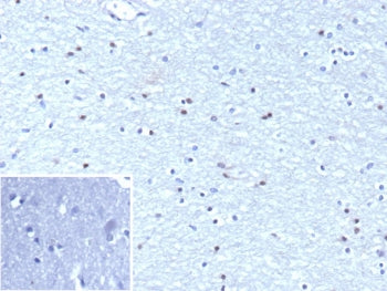 IHC staining of FFPE human brain tissue with Oligodendrocyte transcription factor 2 antibody (clone OLIG2/9995R). Inset: PBS used in place of primary Ab (secondary Ab negative control). HIER: boil tissue sections in pH 9 10mM Tris with 1mM EDTA for 20 min and allow to cool before testing.