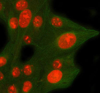 Immunofluorescent staining of CDCA8 using anti-CDCA8 antibody (red) and anti-Beta Tubulin antibody (green). CDCA8 was detected in immunocytochemical section of U2OS cell. Enzyme antigen retrieval was performed using IHC enzyme antigen retrieval reagent for 15 mins. The cells were blocked with 10% goat serum. And then incubated with 5 ug/ml rabbit anti-CDCA8 antibody and mouse anti-Beta Tubulin antibody overnight at 4oC.