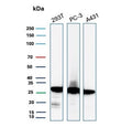 Western blot testing of human 293T, PC-3 and A431 cell lysate with recombinant 14-3-3E antibody. Predicted molecular weight ~28 kDa.
