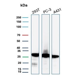 Western blot testing of human 293T, PC-3 and A431 cell lysate with recombinant 14-3-3E antibody. Predicted molecular weight ~28 kDa.