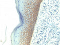 IHC testing of FFPE human skin with E-Cadherin antibody (clone SPM381). Required HIER: boil tissue sections in pH 9 10mM Tris with 1mM EDTA for 10-20 min.