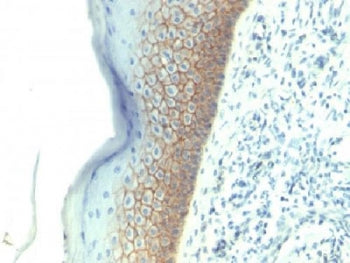 IHC testing of FFPE human skin with E-Cadherin antibody (clone SPM381). Required HIER: boil tissue sections in pH 9 10mM Tris with 1mM EDTA for 10-20 min.