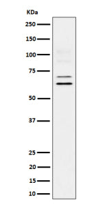 Western blot analysis of BIN1 expression in human U87-MG cell lysate. BIN1 (~65 kDa predicted) was detected as multiple bands at ~65 and ~70 kDa, with faint higher species near ~100 kDa, consistent with known tissue-specific splice variants and post-translationally modified BIN1 isoforms.
