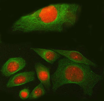 Immunofluorescent staining of FFPE human SiHa cells with SPAG7 antibody (red) and Alpha Tubulin mAb (green). HIER: steam section in pH6 citrate buffer for 20 min.