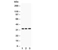 Western blot testing of MPG antibody and Lane 1: rat liver; 2: human HeLa; 3: (h) Jurkat. Predicted molecular weight: ~33kDa.