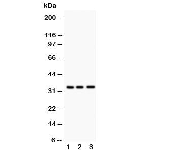 Western blot testing of MPG antibody and Lane 1: rat liver; 2: human HeLa; 3: (h) Jurkat. Predicted molecular weight: ~33kDa.