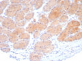 IHC staining of FFPE human stomach tissue with Beta-Parvin antibody (clone PARVB/8214R). HIER: boil tissue sections in pH 9 10mM Tris with 1mM EDTA for 20 min and allow to cool before testing.