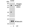 Western blot testing of lysate from human Jurkat cells treated or non-treated with CIP/CIAP (calf intestinal alkaline phosphatase) with phospho-MeCP2 antibody. Commonly observed molecular weights: ~55 kDa and ~75 kDa.