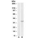 Western blot testing of human heart lysate with JAM2 antibody at 0.5ug/ml with [B] and without [A] blocking/immunizing peptide. Predicted molecular weight: ~33kDa.