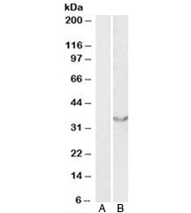 Western blot testing of human heart lysate with JAM2 antibody at 0.5ug/ml with [B] and without [A] blocking/immunizing peptide. Predicted molecular weight: ~33kDa.