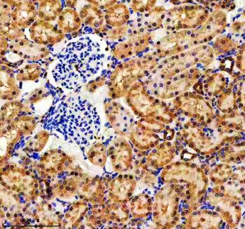 Immunohistochemical staining of EVC2 using anti-EVC2 antibody. EVC2 was detected in a paraffin-embedded section of rat midbrain tissue. Heat mediated antigen retrieval was performed in EDTA buffer (pH 8.0, epitope retrieval solution). The tissue section was blocked with 10% goat serum. The tissue section was then incubated with 2 ug/ml rabbit anti-EVC2 antibody overnight at 4oC. Peroxidase Conjugated Goat Anti-rabbit IgG was used as secondary antibody and incubated for 30 min at 37oC.
