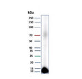Western blot testing of human pancreas tissue lysate with Colipase antibody (clone CLPS/9026). Predicted molecular weight ~12 kDa.