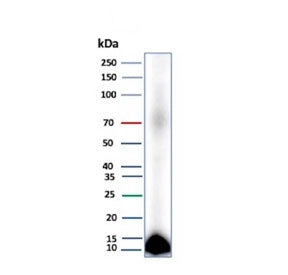 Western blot testing of human pancreas tissue lysate with Colipase antibody (clone CLPS/9026). Predicted molecular weight ~12 kDa.